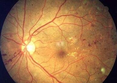 ����ʯīϩ�������˹�ҕ�WĤ ��׌�ۼ�������Ҋ���� 