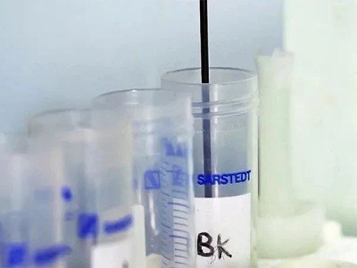 Ͷ�Y70�|����A�Ƽ��U�a�늲���