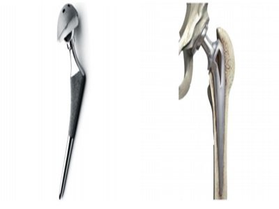 ���h(hu��n)����TC-BIO�մ��y�P(gu��n)��(ji��)�����ɹ�ͨ�^���ęn��ӛ