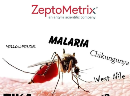 ֱ����׿������飺 ZeptoMetrix�F؛��ԭ�wԭ���c�|��Ʒ����푑�����