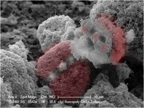 �㿴������΢�^���磺��R�µļ{��ˇ�g