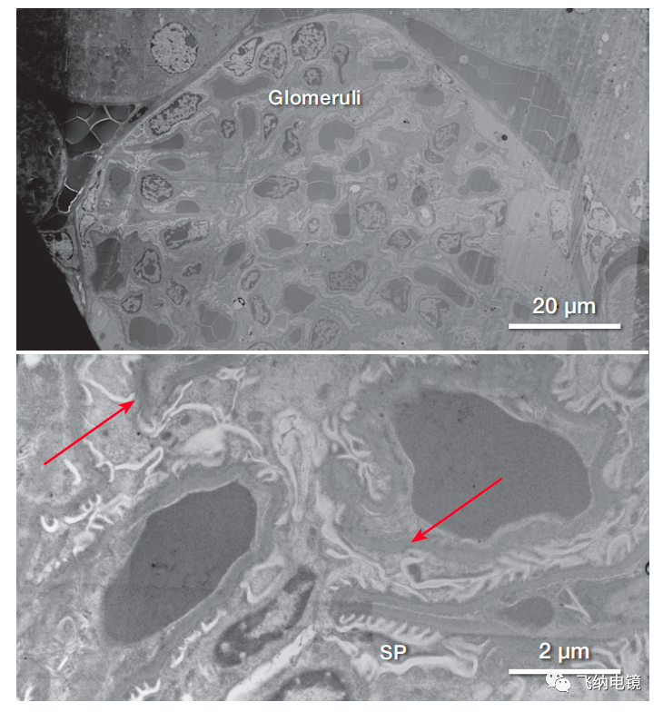 小鼠腎標本樣品(腎小球和臨近的腎血管)的 STEM 圖