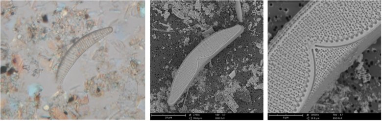 掃描電鏡測硅藻