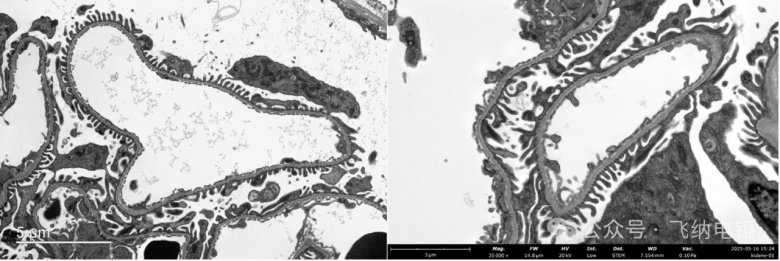 152747_628791_gsdt.png 152747_628791_gsdt.png