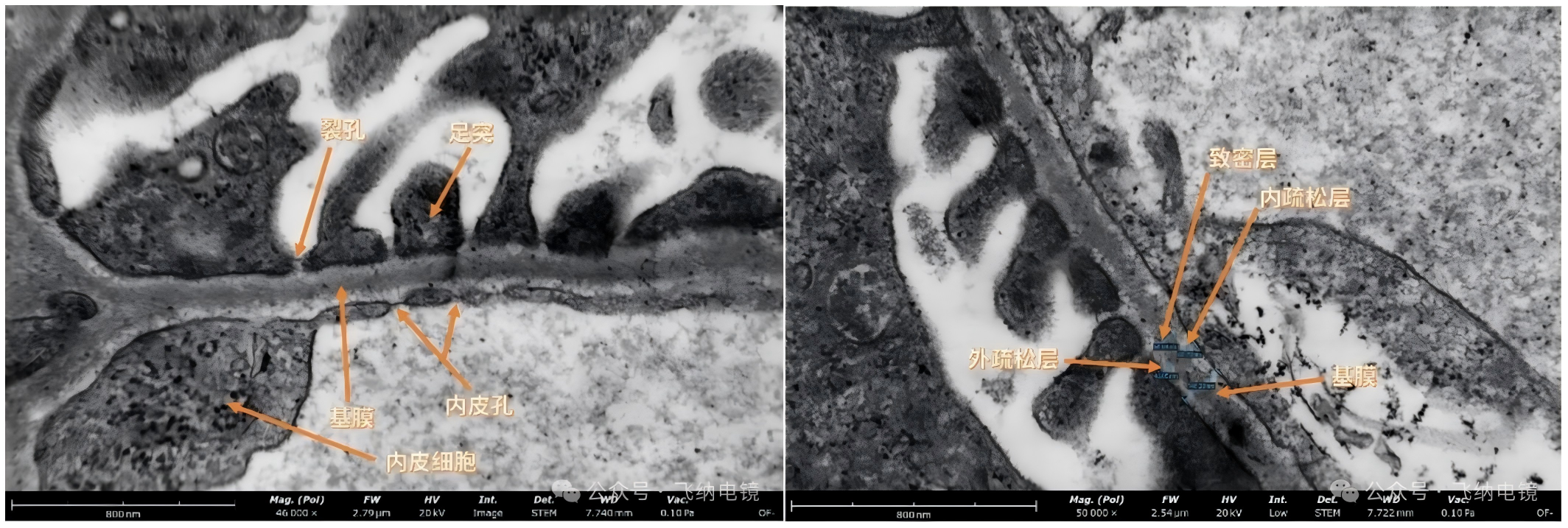 臺式掃描透射電鏡下小鼠腎組織